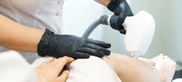 Dauerhafte Haarentfernung Leaseir Damen DERMAVIVA