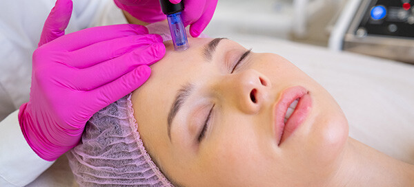 Microneedling DERMAVIVA