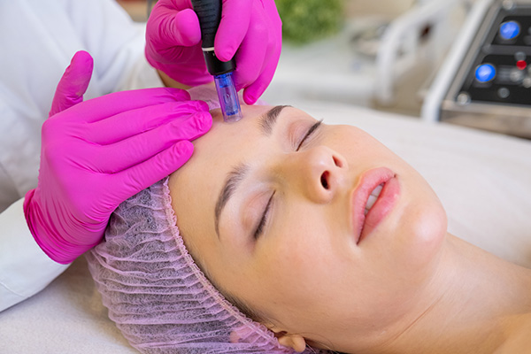 Microneedling DERMAVIVA
